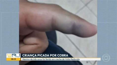 Vídeo Menino de três anos é picado por cobra no pátio de creche em