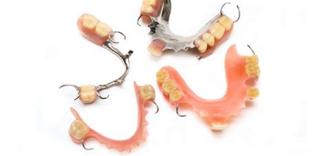 Metal Or Acrylic Partial Dentures Which One Is Best For You