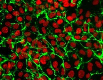 Cellular Fibronectin EDA In Tumor Progression And Inflammation