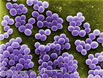 Eubacteria - 6 Kingdoms of Life