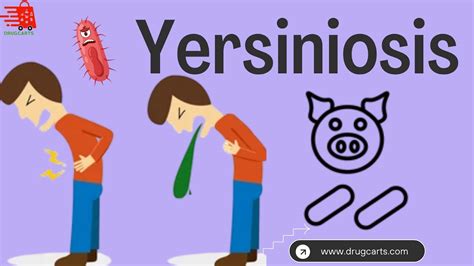 Yersiniosis - An Contagious Disease