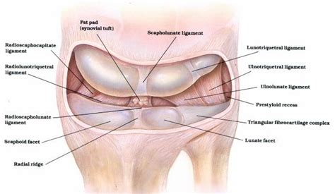 Scapholunate Ligament Tears