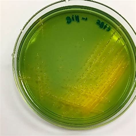 Vibrio Grow On The Tcbs Agar Plate Swabbed From The Fish Gill