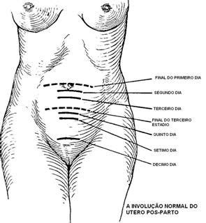 Blog Enfermagem Original Involu O Uterina Pop Procedimentos