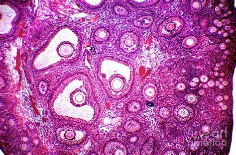 Ovary Histology Ovum