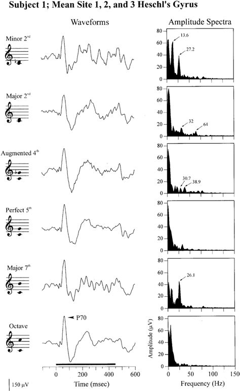 Waveforms And Amplitude Spectra Of Chord Evoked AEPs Averaged Across 3