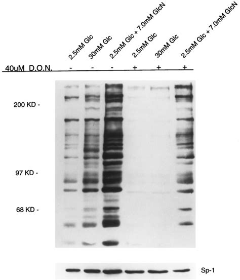 Glucose Metabolism To Glucosamine Is Necessary For Glucose Stimulation