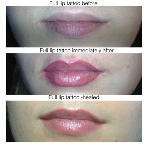 Lip Liner Tattoos Permanent Makeup Calgary Cinnamon Girl Clinic Skin Treatments