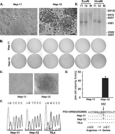 Characterization Of Two Hcc Cell Lines From A Patient’s Primary And Download Scientific Diagram