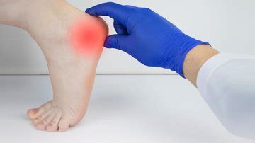 Arthrose du pied Symptômes et traitements