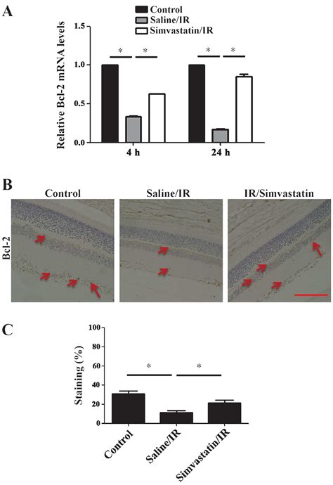 Simvastatin Inhibits Ischemia Reperfusion Injury Induced Apoptosis Of