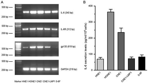 Interleukin 6 Promotes The Migration And Invasion Of Nasopharyngeal