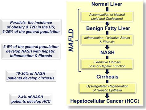 Transition from normal liver to primary HCC. HCC, hepatocellular ...