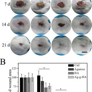 The Wound Healing Experiment In Mice A Representative Gross Images