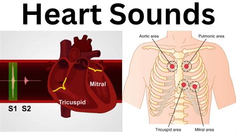 Heart Sounds S1 S2 Areas Of Auscultation Easiest Explanation With