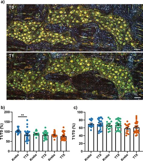 Effect Of Tetrodotoxin On D Ffoct Signal A D Ffoct Micrograph Of The