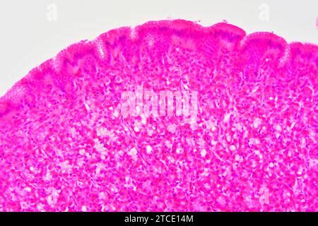 Sezione Trasversale Dello Stomaco Che Mostra Mucosa Sottomucosa E