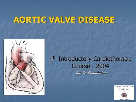 Ppt Aortic Valve Disease Powerpoint Presentation Free Download Id 1195841