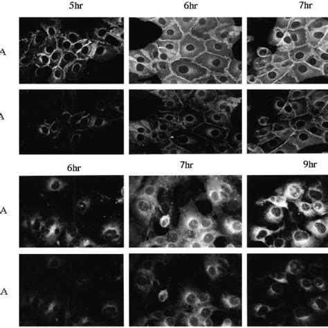 Localization Of The Ha And Na Proteins In Infected Mdck And Cos Cells