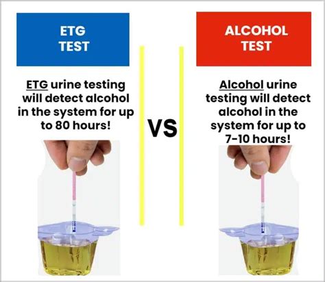 What Is The ETG Alcohol Test Ovus Medical