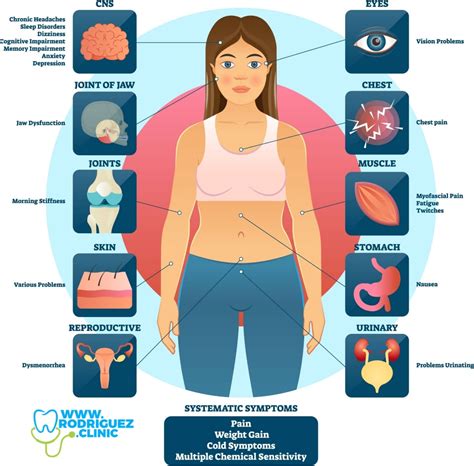 Fibromialgia D Nde Est N Los Puntos De Dolor A Detectar