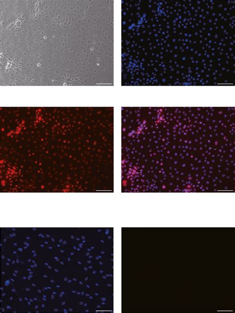 The Expression Of Pax6 In Hce T Cells By Immunofluorescence Staining