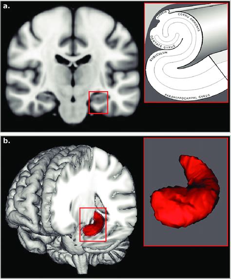 A Hippocampal Subfields B Example Of Left Hippocampal Segmentation