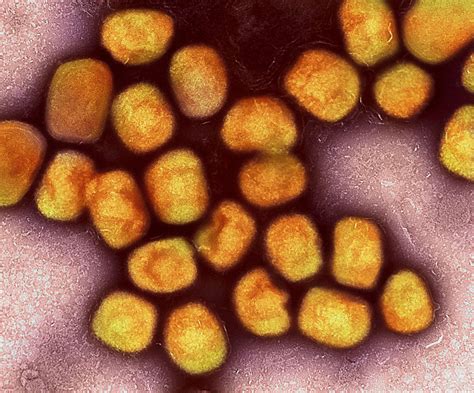 Epidemie Im Kongo Who Warnt Vor Infektionskrankheit Mpox