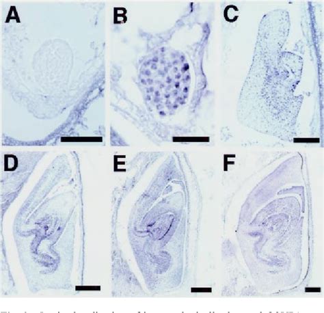 Figure From Temporal And Spatial Expression Pattern Of The Osvp And