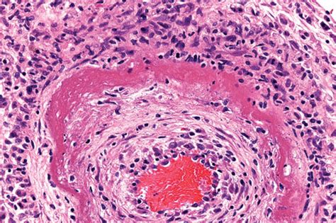 Saponification Histology