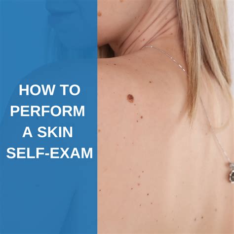 How To Perform A Skin Self Exam Savannah River Dermatology