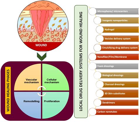 Pharmaceutics Free Full Text Local Drug Delivery Strategies Towards