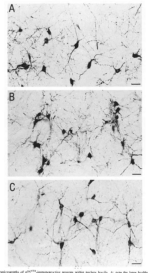 Figure From Atrophy Of Cholinergic Basal Forebrain Neurons Following