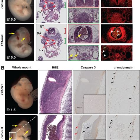 Vascular Leakage In Friend Leukemia Integration Fli Null Embryos