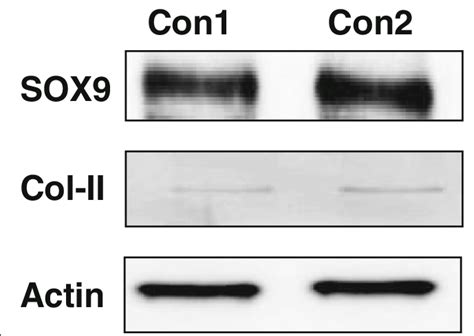 Phenotypic Characterization Of Human Chondrocytes Western Blot Download Scientific Diagram