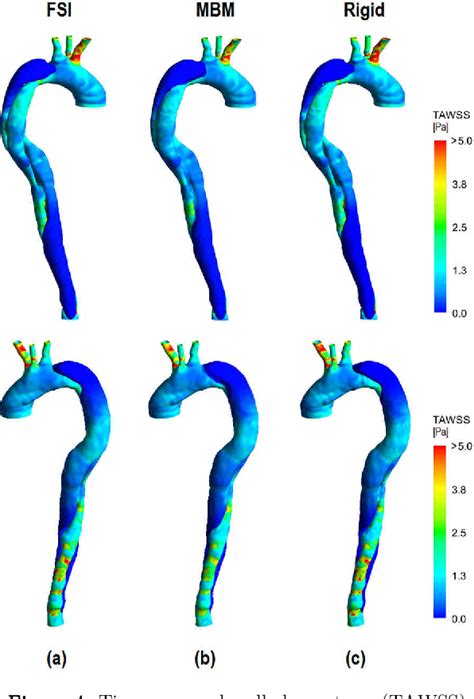 Figure From A Simplified Method To Account For Wall Motion In Patient