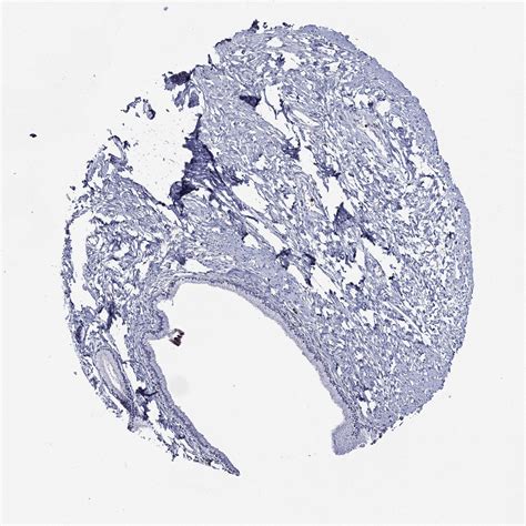 Tissue Expression Of Gpr171 Staining In Cervix The Human Protein Atlas