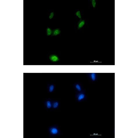 Phospho Amyloid Precursor Protein Thr743 Rabbit Mab Wb Ip Icc