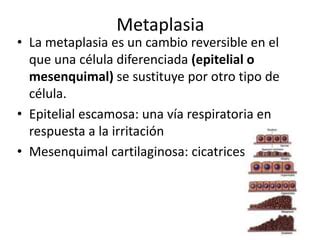 Aplasia Metaplasia Displacia Neoplasia PPT