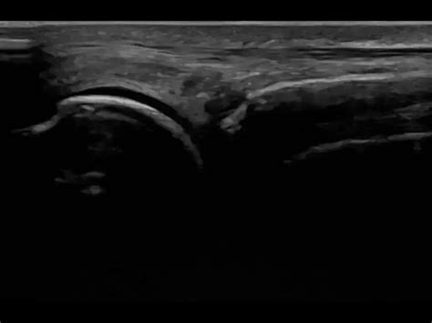 Musculoskeletal Ultrasound Msk Care Pathway Logiq™