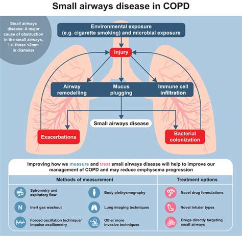 Why We Should Target Small Airways Disease In Our Management Of Chronic