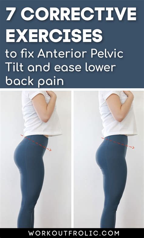 Anterior Pelvic Tilt Exercises To Correct NBKomputer