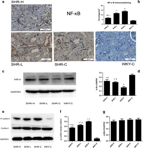 NF κB localization and cofilin1 activity in the kidneys of SHRs a b