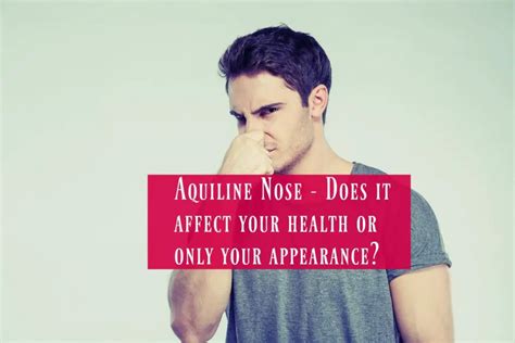 Aquiline Nose - Does it affect your health or only your appearance ...