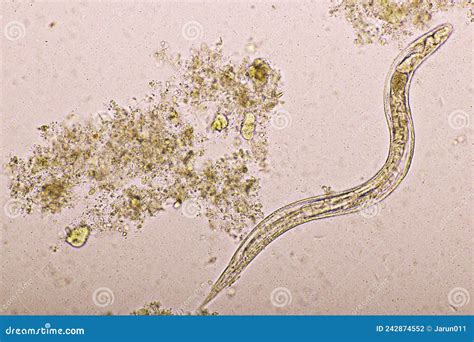 Strongyloides Stercoralis Or Threadworm In Human Stool Stock Photo