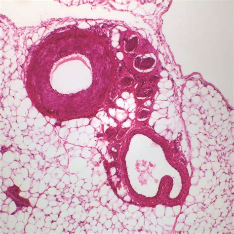 Mammal Artery And Vein C S 7 µm Hande Microscope Slide