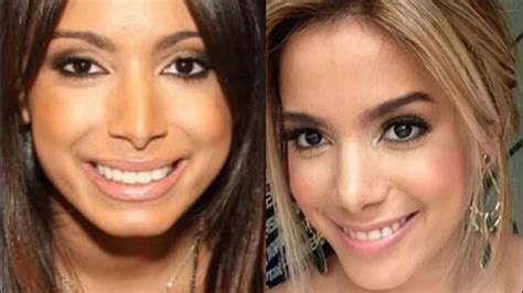 El Antes Y Despu S De Anitta Cu Ntas Cirug As Tiene La Cantante