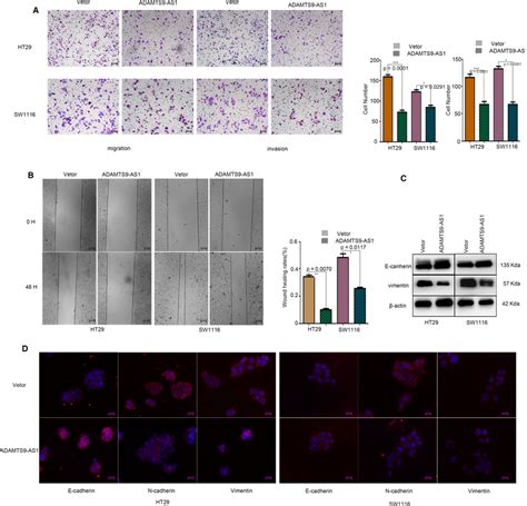 Overexpression Of Adamts As Suppresses Tumour Metastasis And