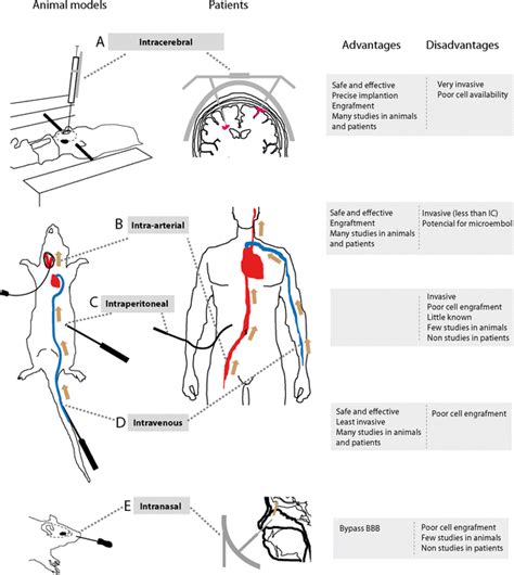 Stem Cell Therapy And Administration Routes After Stroke Springerlink