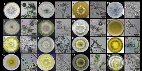 Morphological Characteristics Of Trichoderma Species Colony Grown On